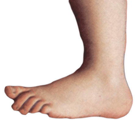 MontyPythonFoot